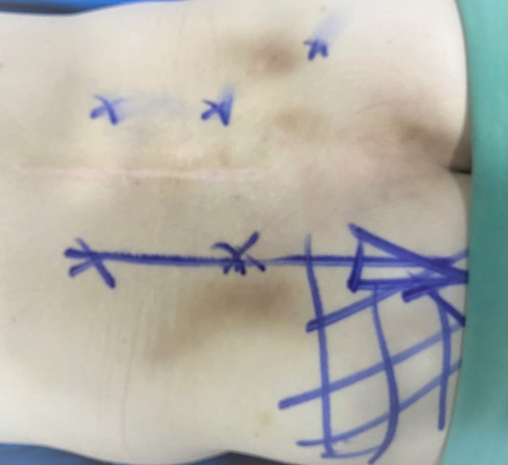 CÔNG TY TNHH Y TẾ HÀ ĐÔ - HADO MEDICAL