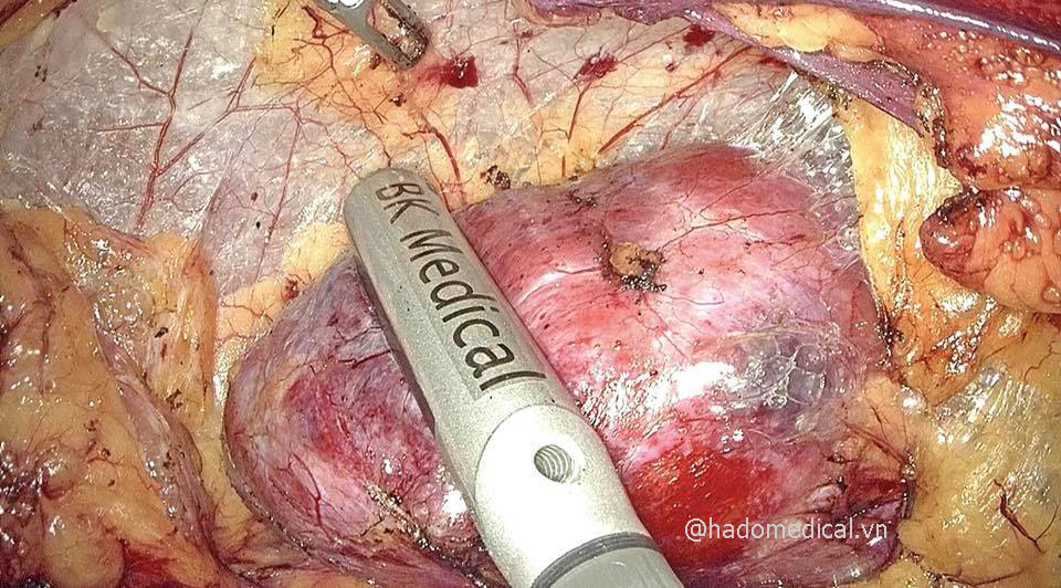 CÔNG TY TNHH Y TẾ HÀ ĐÔ - HADO MEDICAL