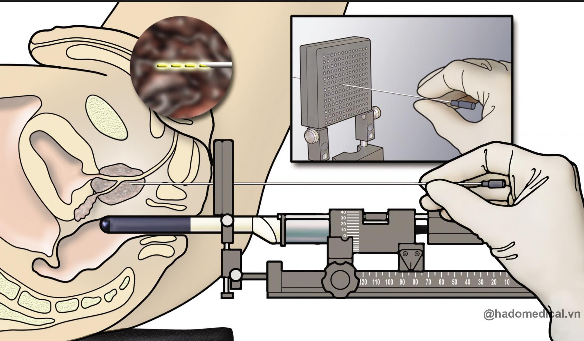 CÔNG TY TNHH Y TẾ HÀ ĐÔ - HADO MEDICAL