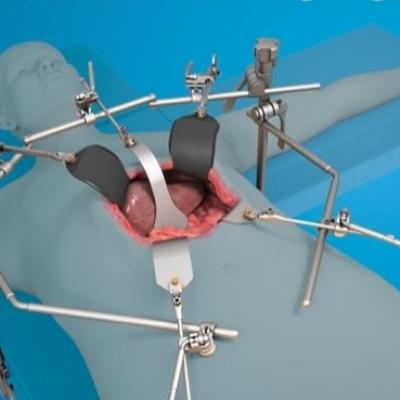 Khung gá đỡ phẫu thuật