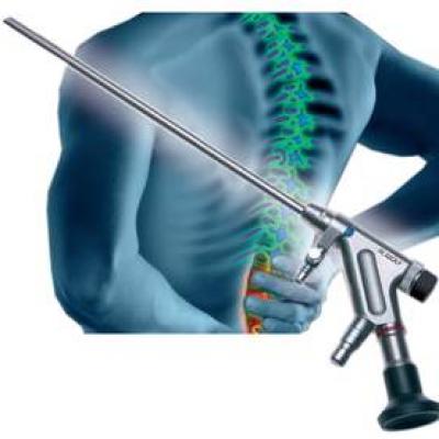 Dụng cụ phẫu thuật nội soi cột sống